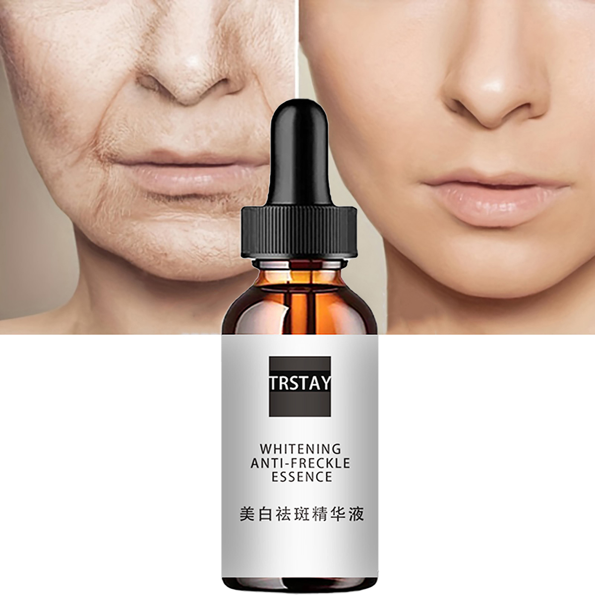 Nicinamide Acid Esens Wajah Pe - Niacinamide Pore Shrinking Essence ulasan dan harga