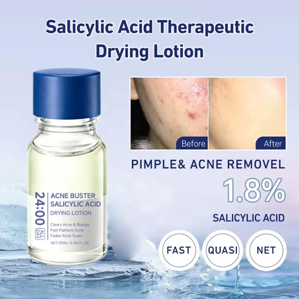 Asam Salisilat Penghilang Jera - Salicylic Acid Blackhead Remover ulasan dan harga